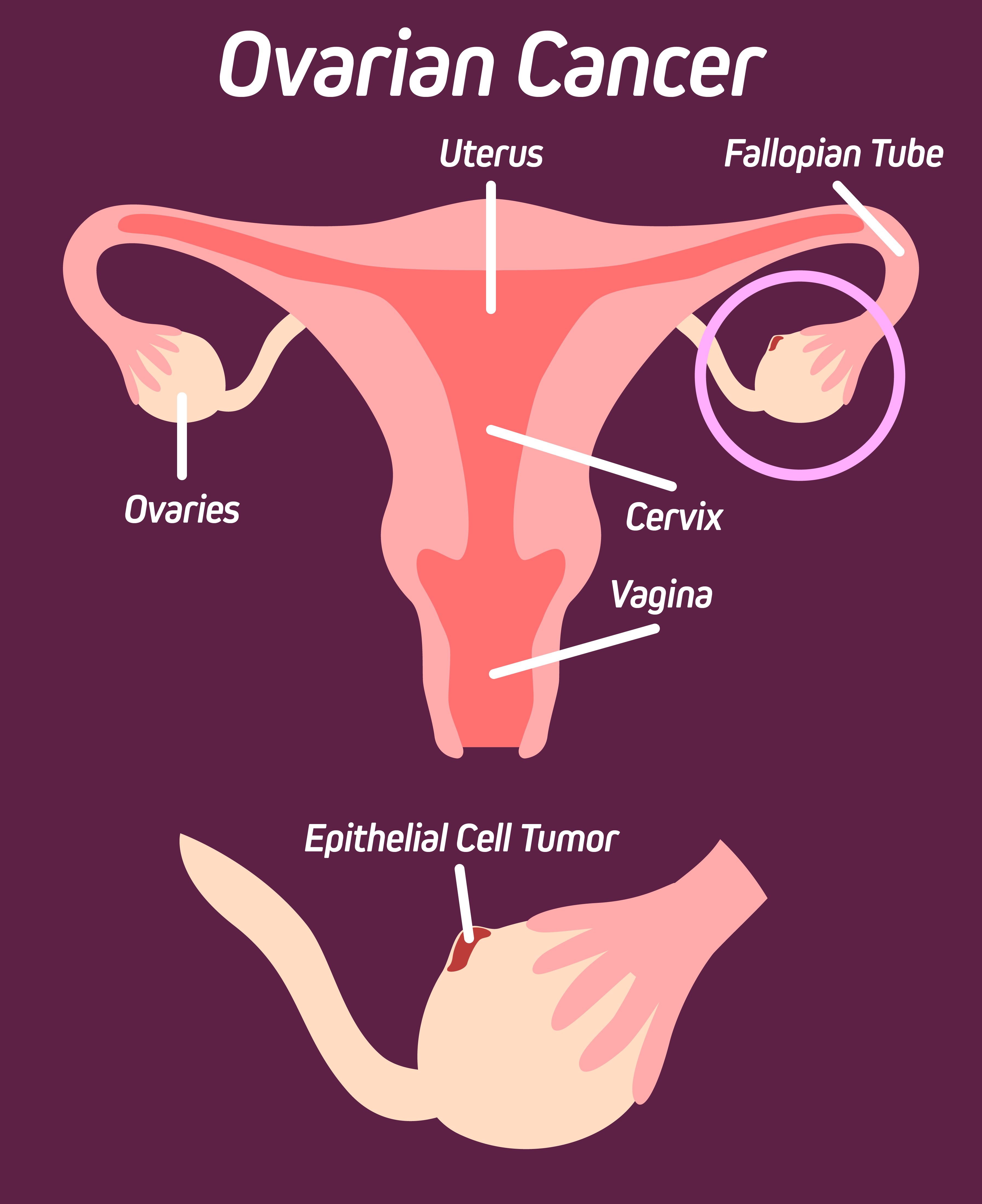 epithelial_infographic-01