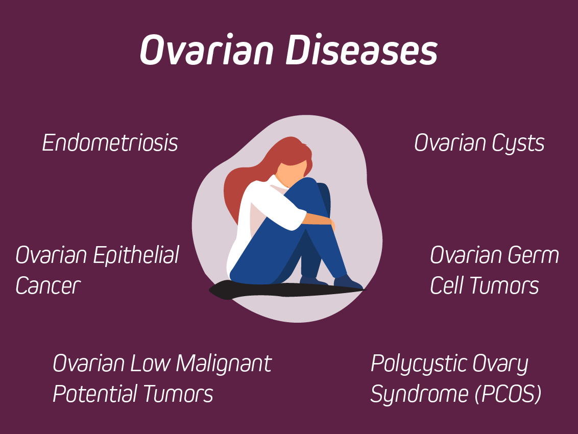 ovarianDiseases-01