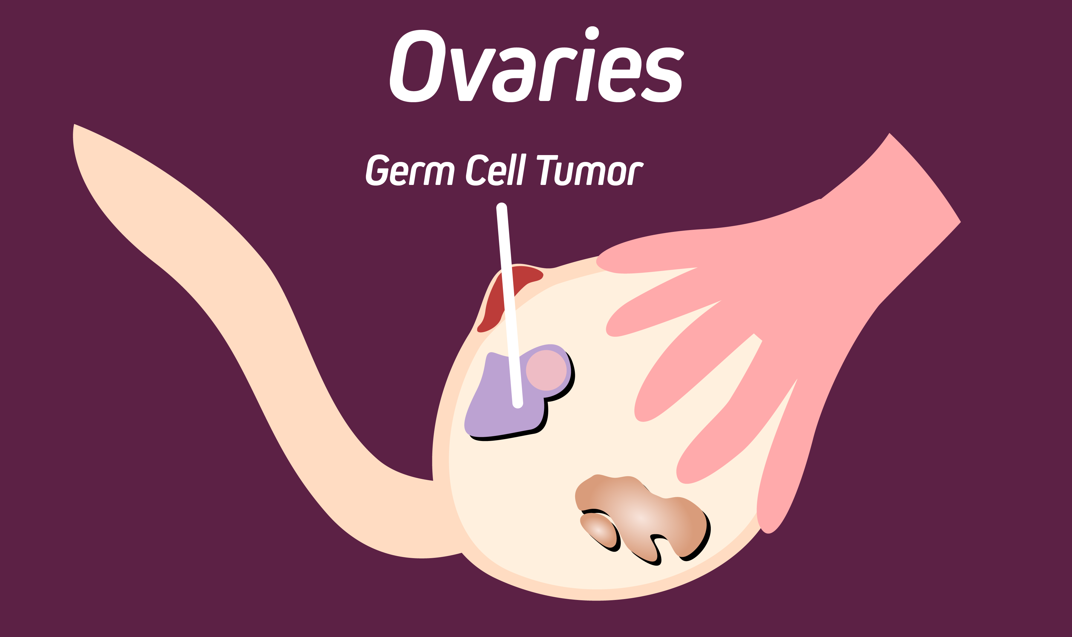 ovaries_germ-01
